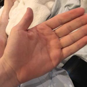 picture of hand